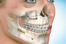 orthodontics